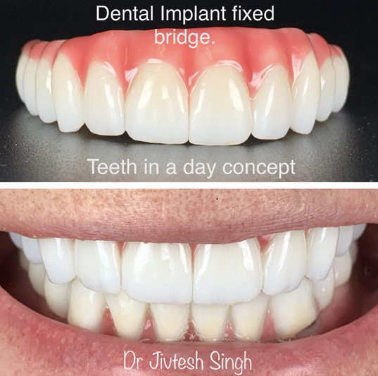 Top Rated Implant Dentist