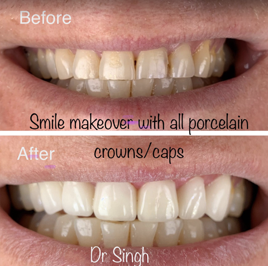 Cosmetic Dentistry in Shirley